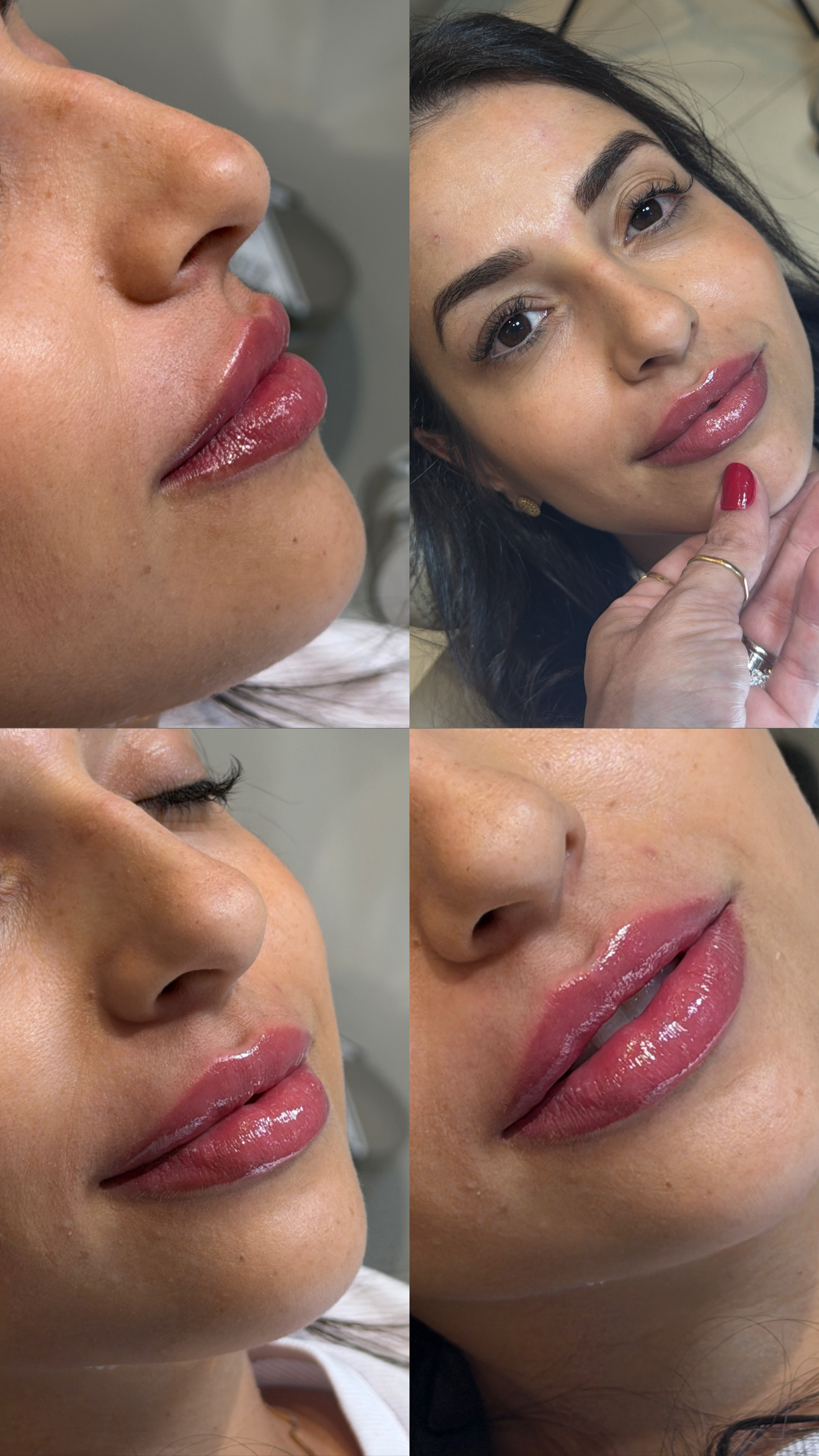 Antes e Depois — Caso 3