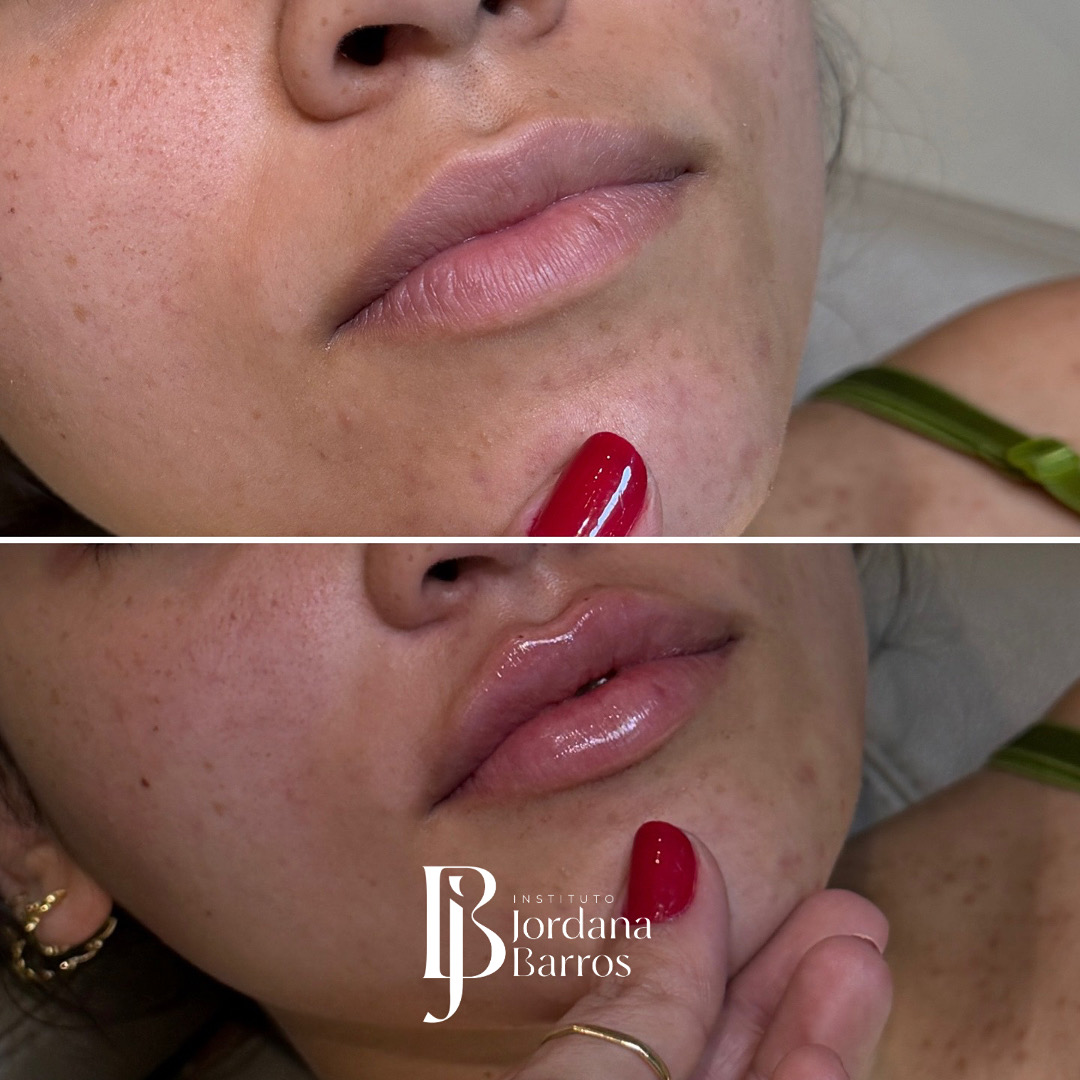 Antes e Depois — Caso 4