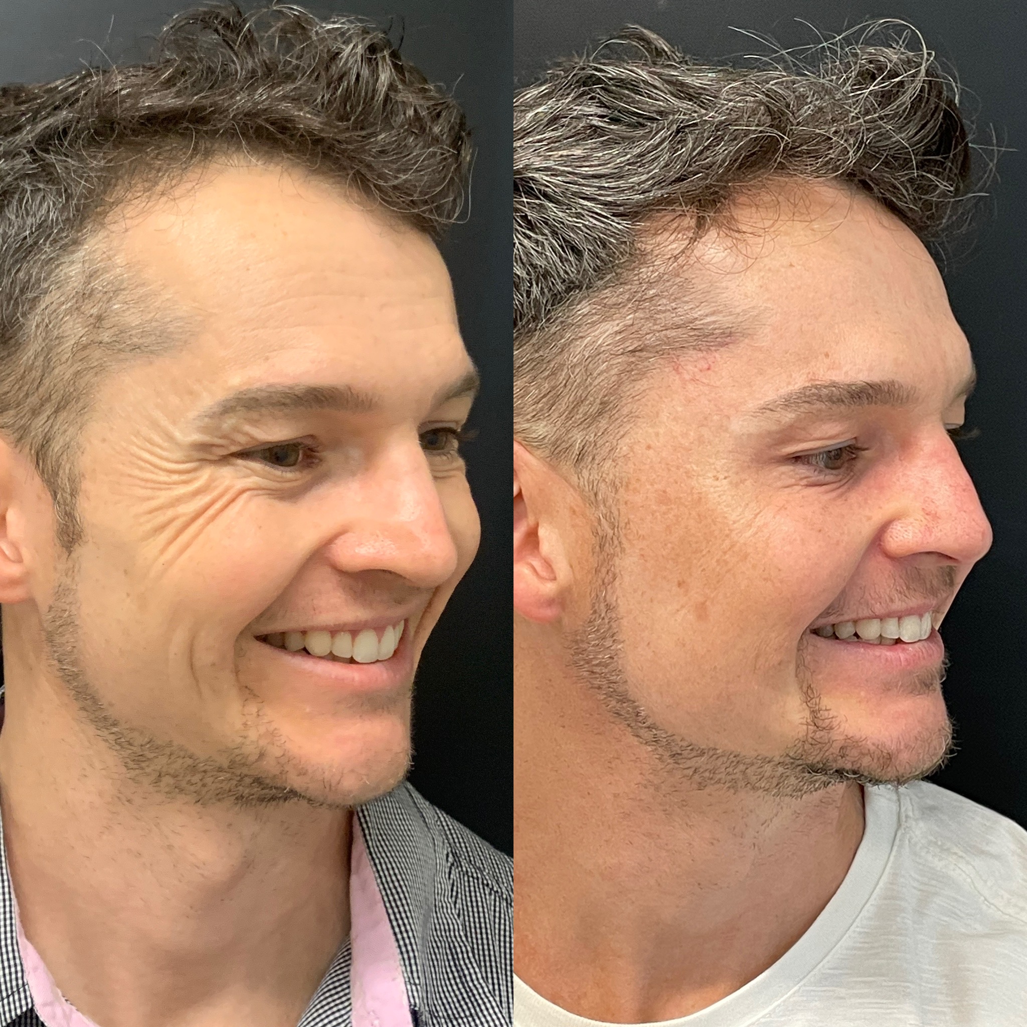 Antes e Depois — Caso 5