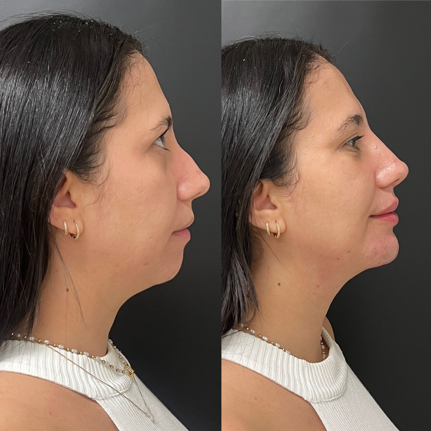 Antes e Depois — Caso 6