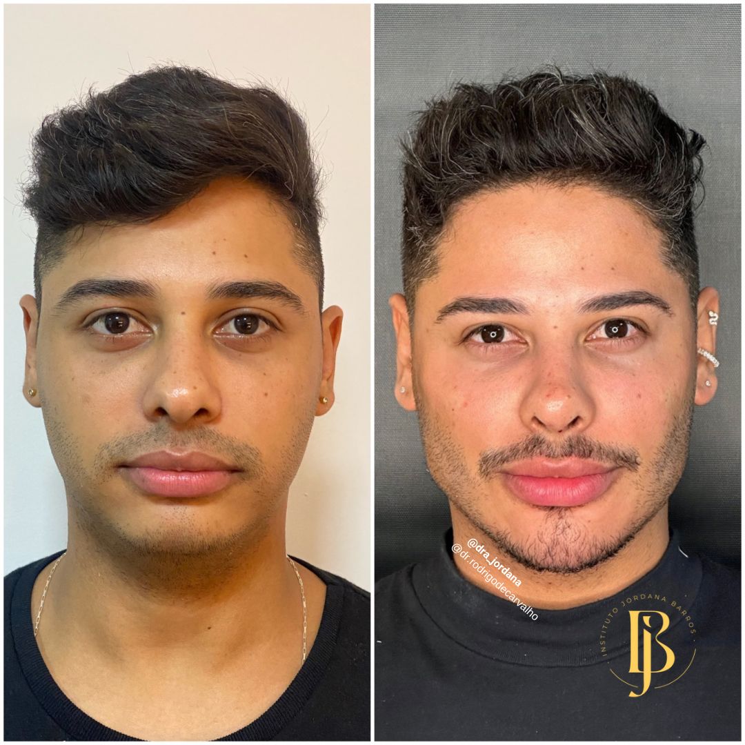 Antes e Depois — Caso 7